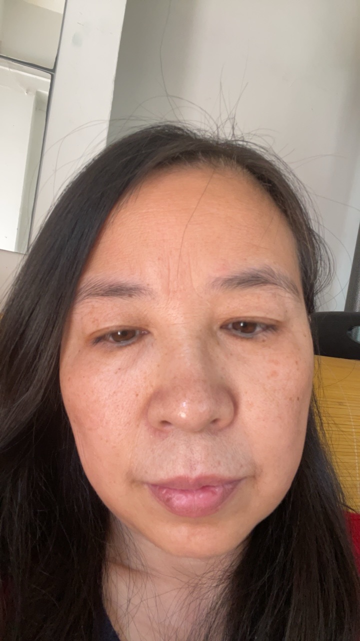 王护工照片