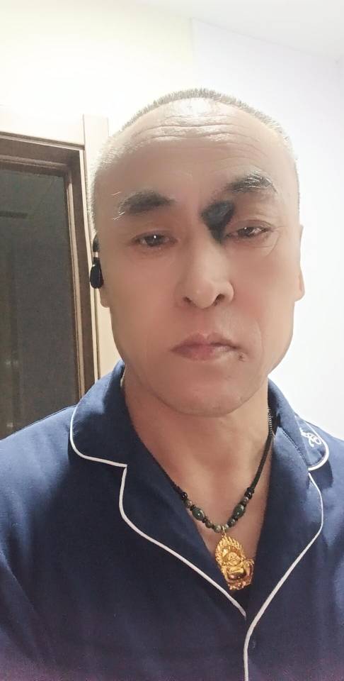 李护工照片