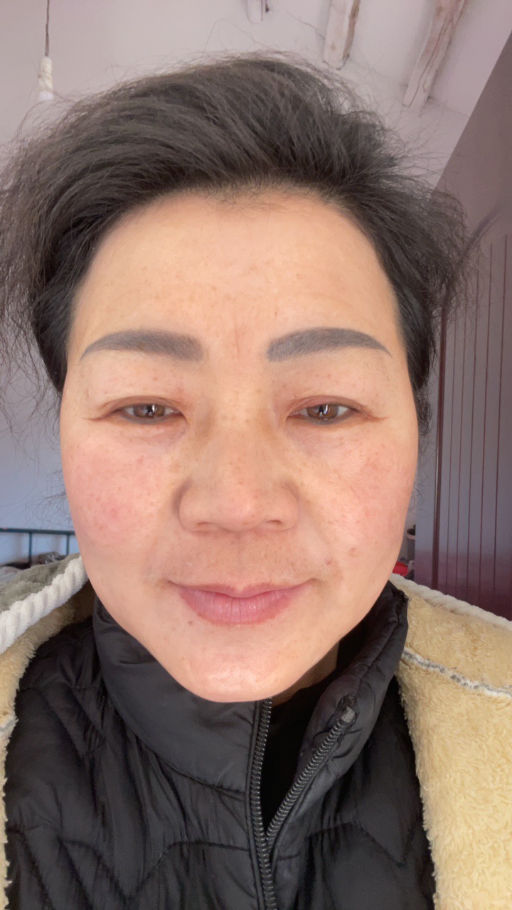 常护工照片