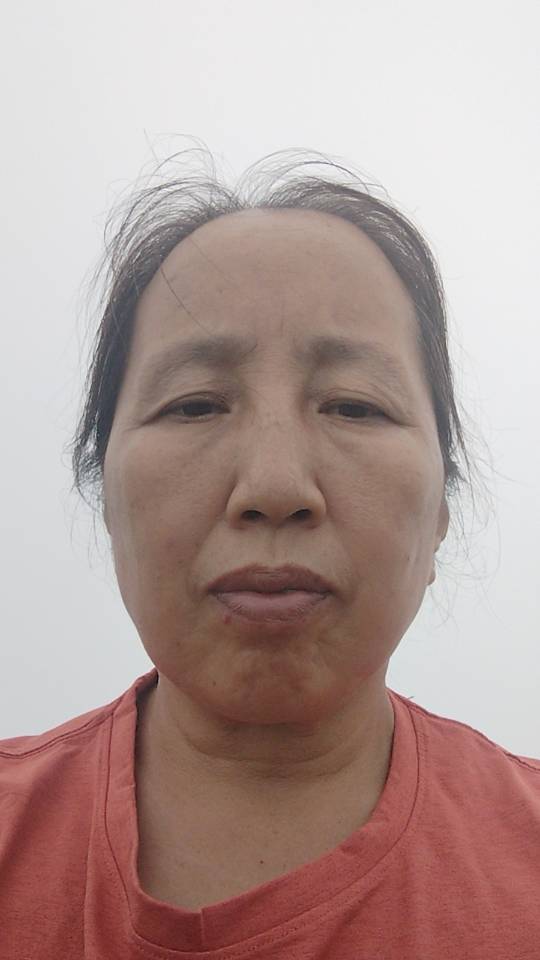张阿姨照片