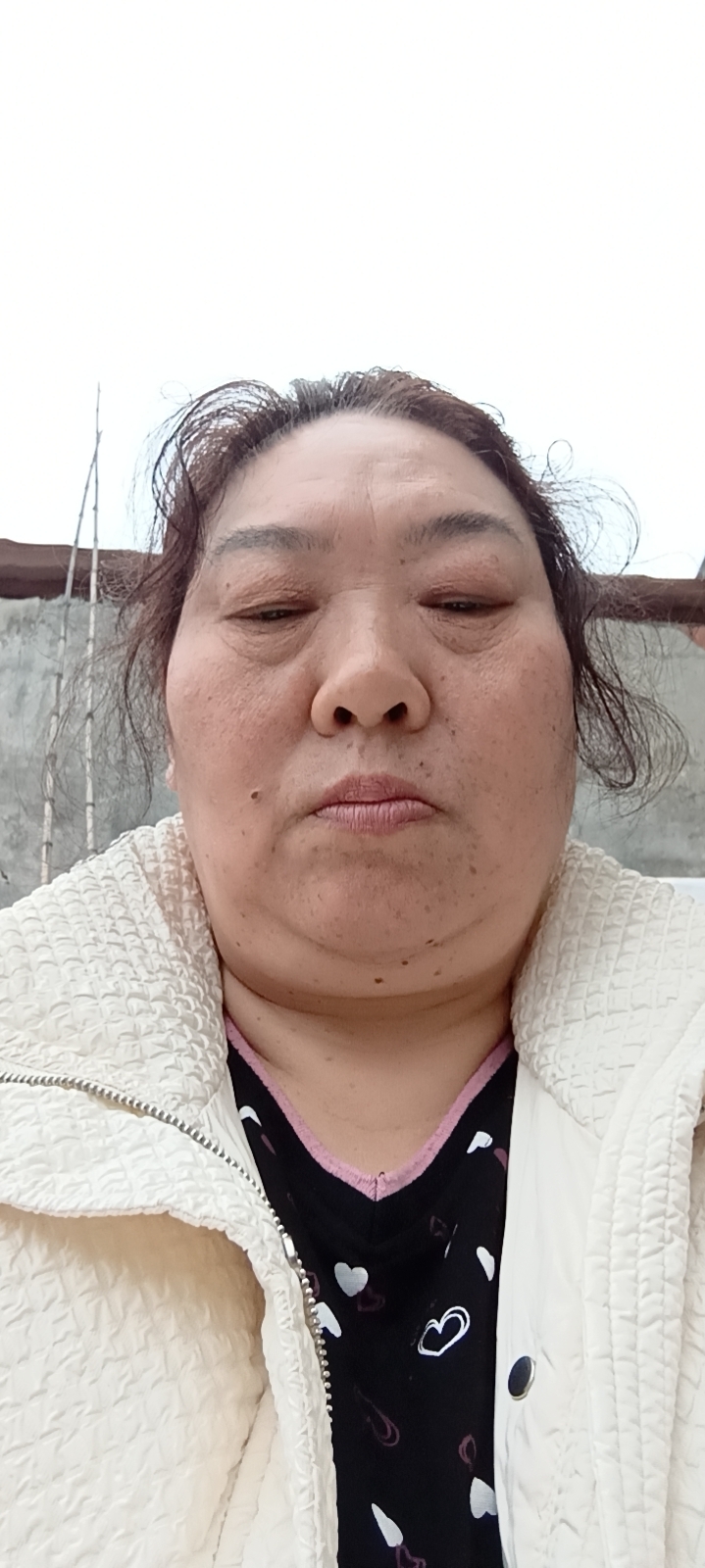 张护工照片