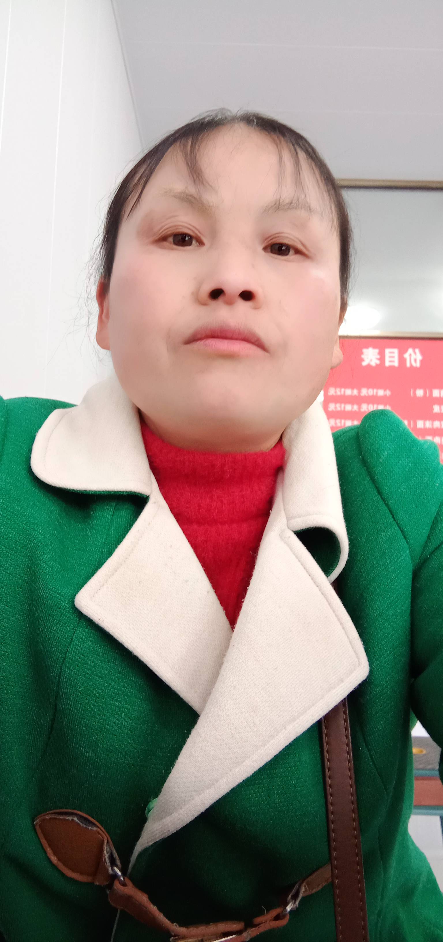 张护工照片