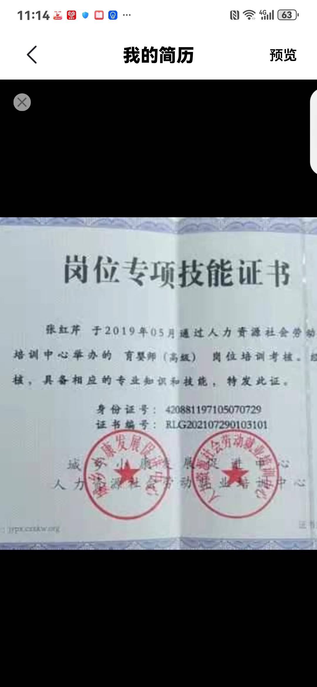 张护工照片