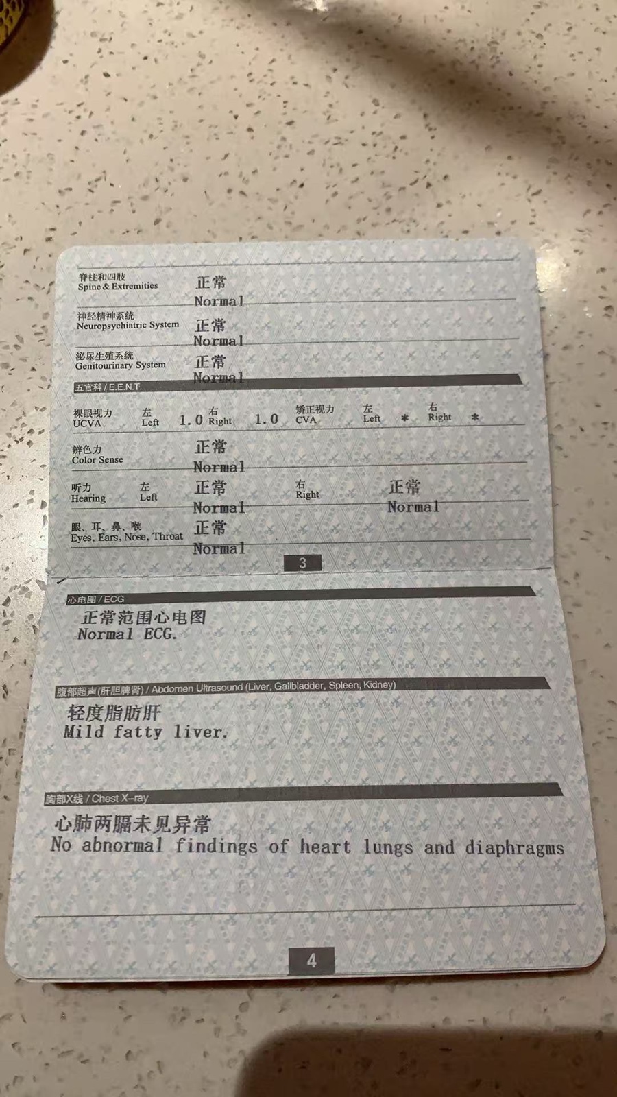 张阿姨照片