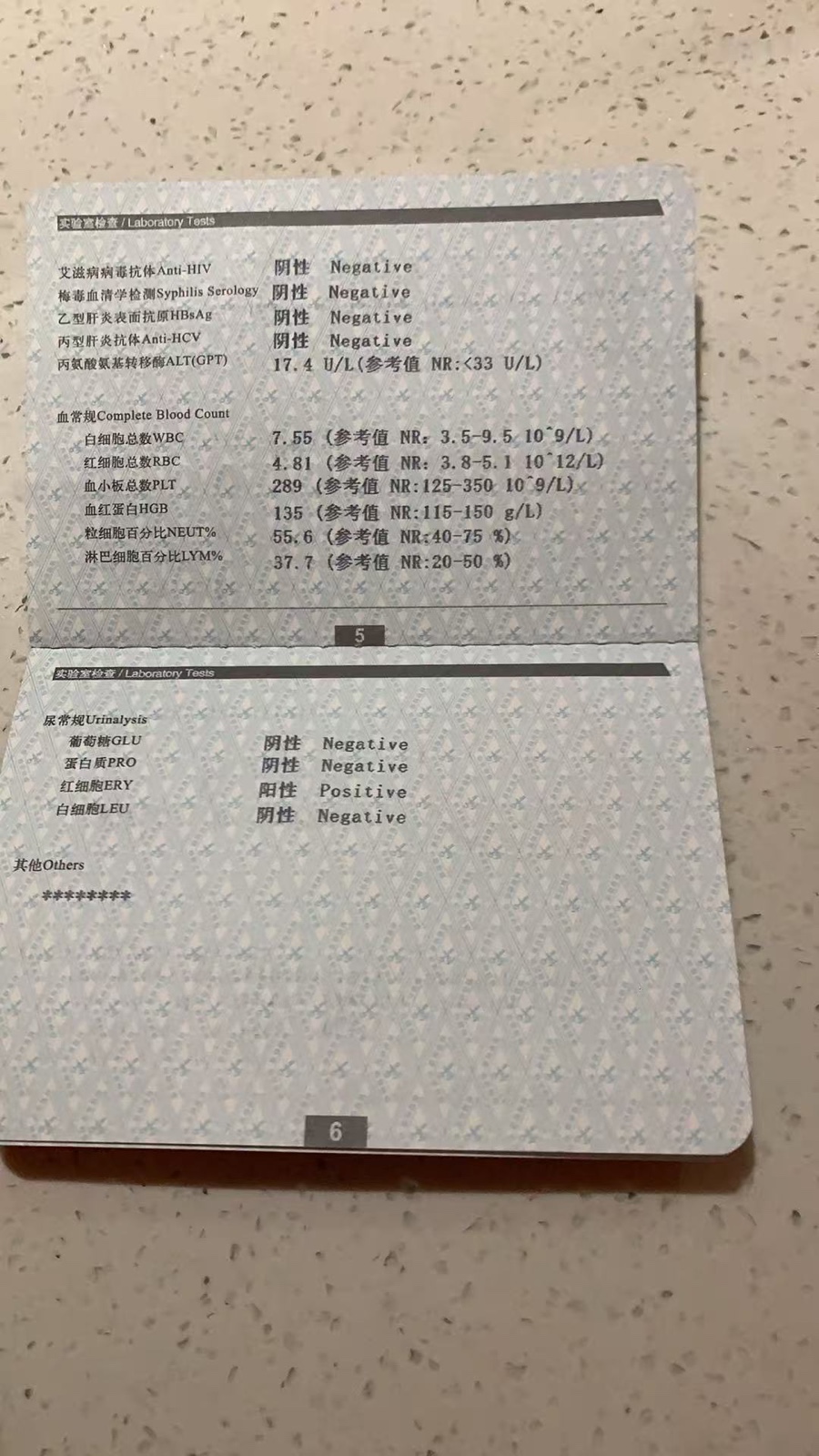 张阿姨照片