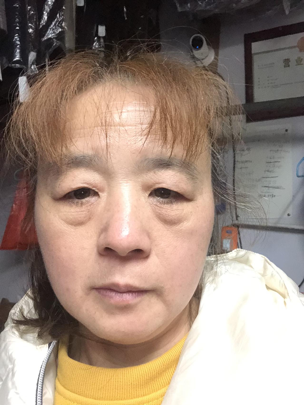许阿姨照片