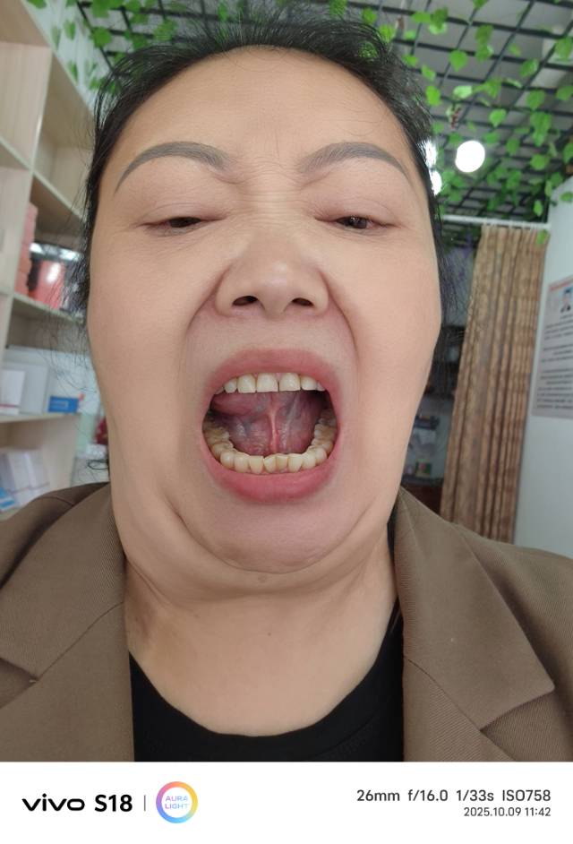 张阿姨照片