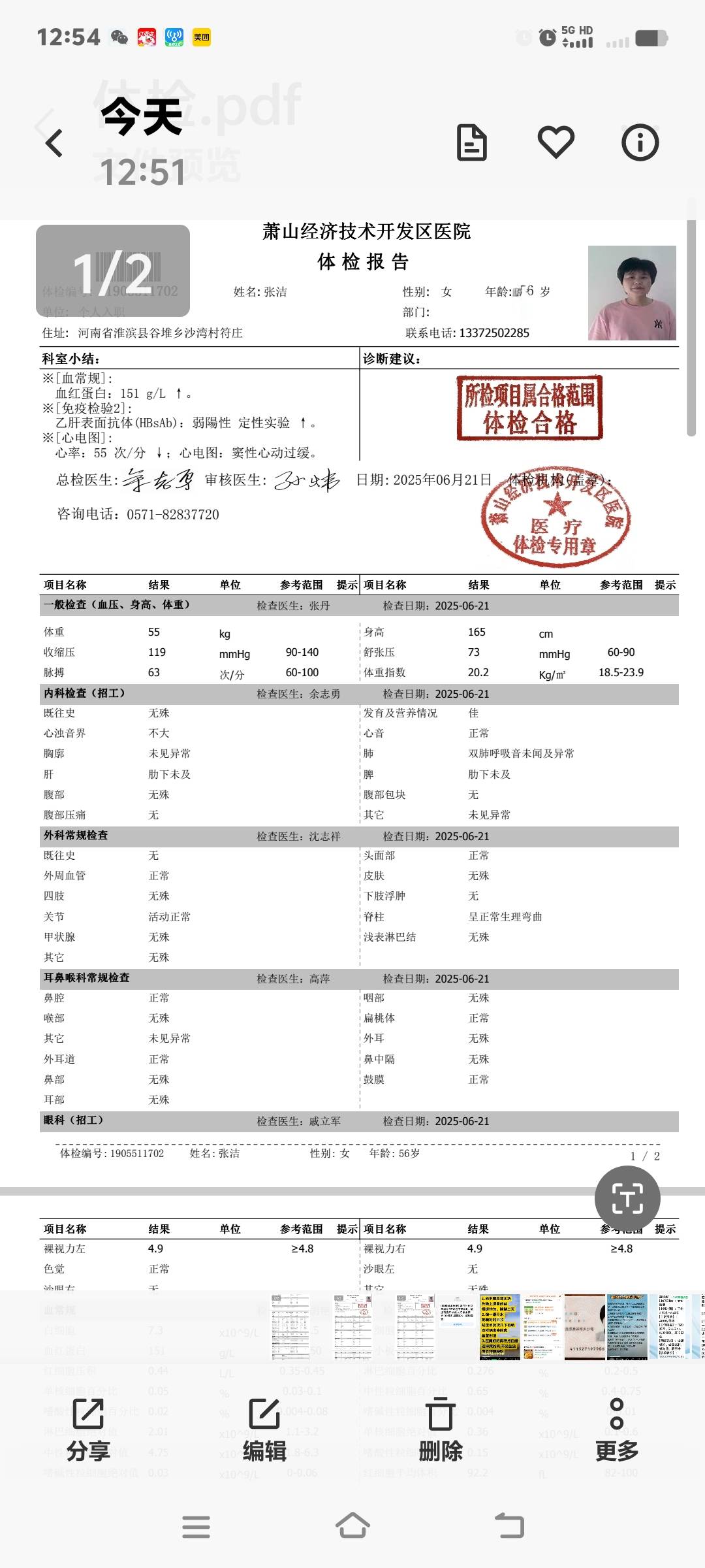 张阿姨照片