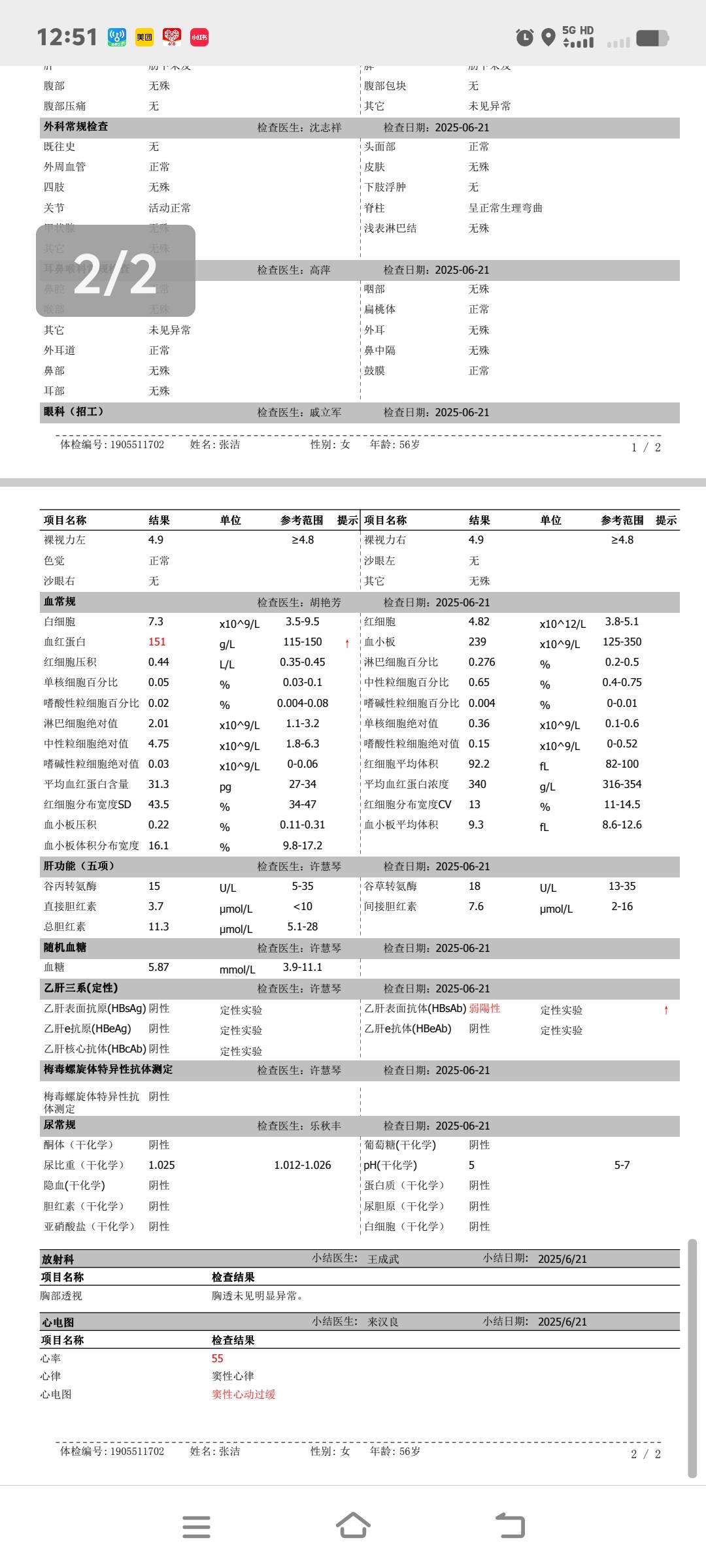张阿姨照片