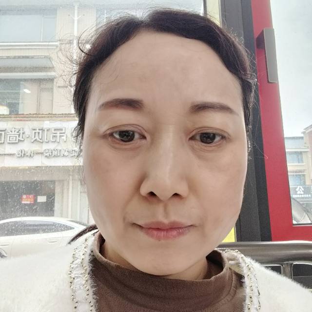 张阿姨照片