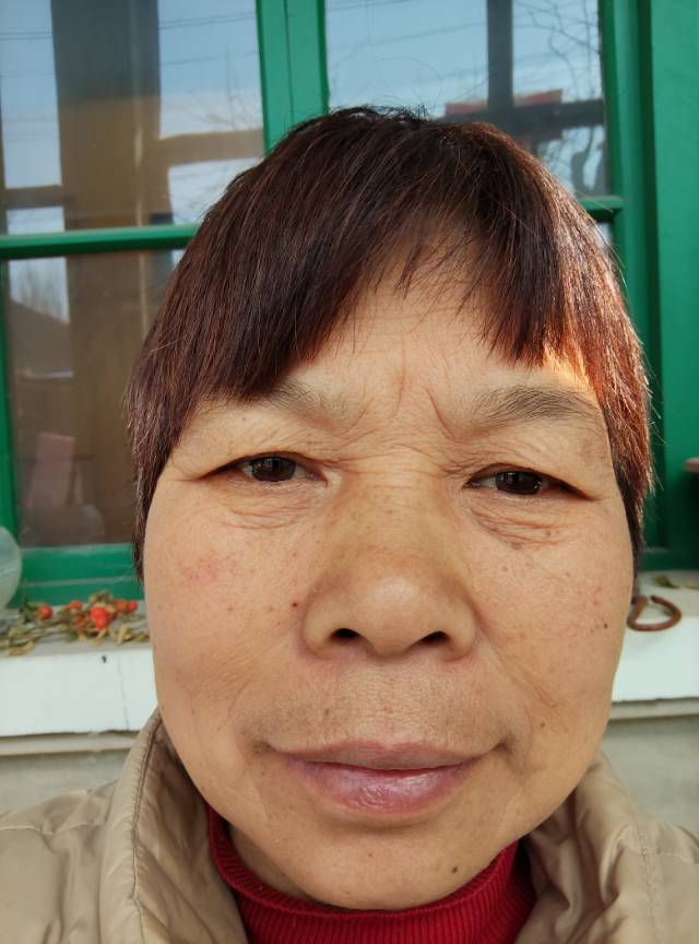 王护工照片
