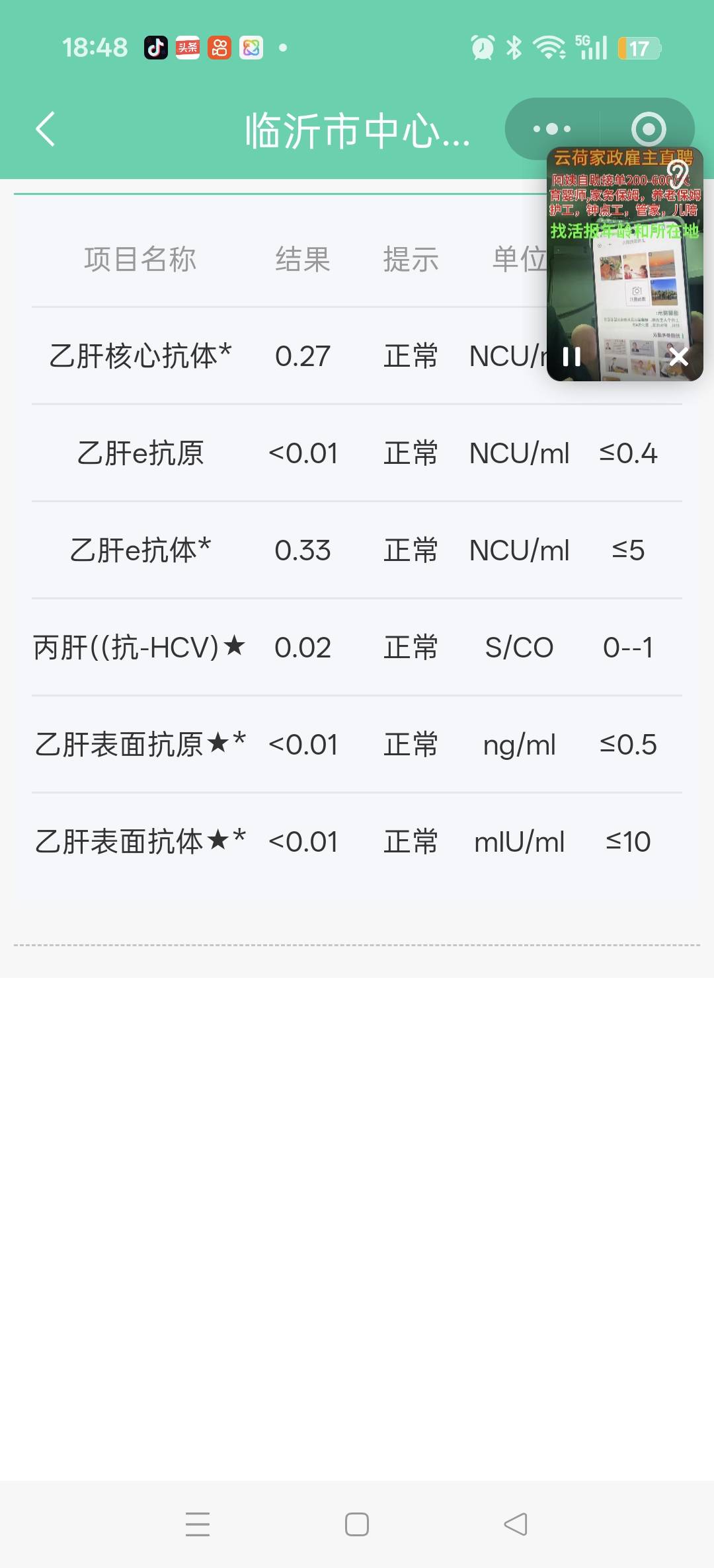 王护工照片