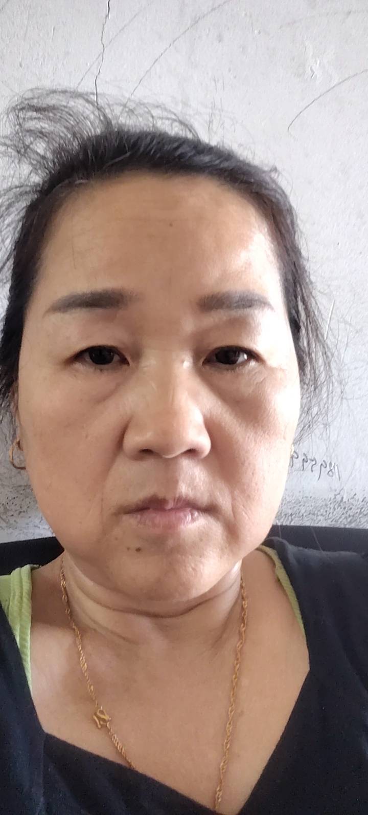张阿姨照片