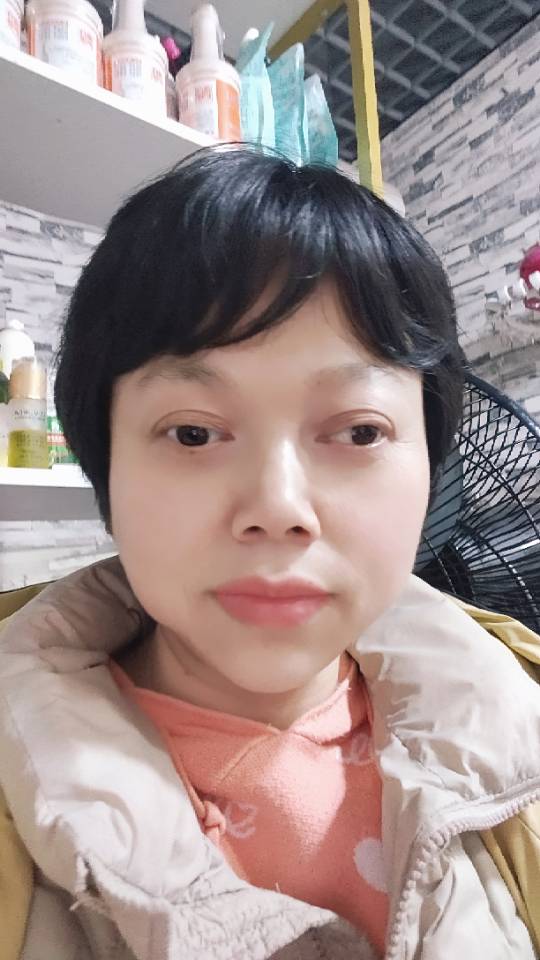 王护工照片