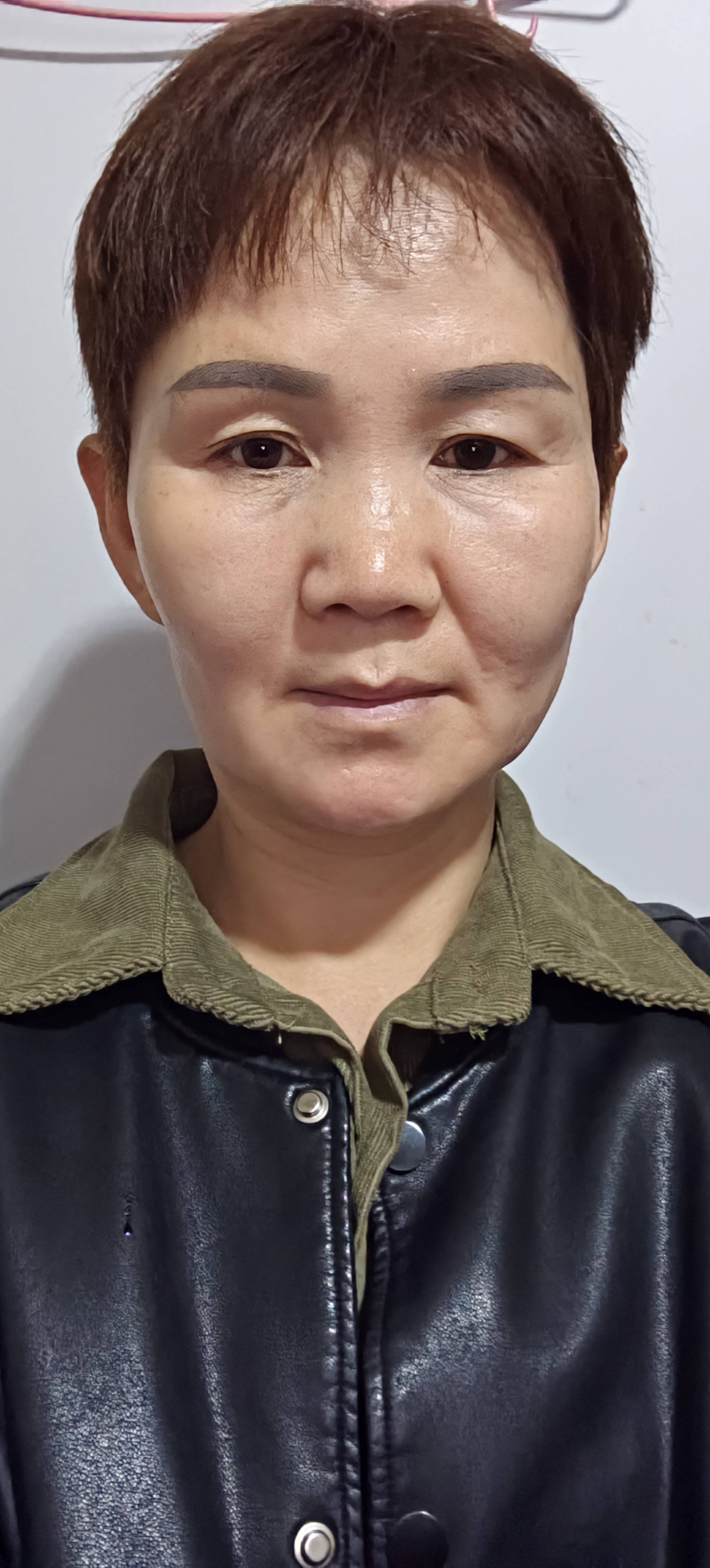 步护工照片