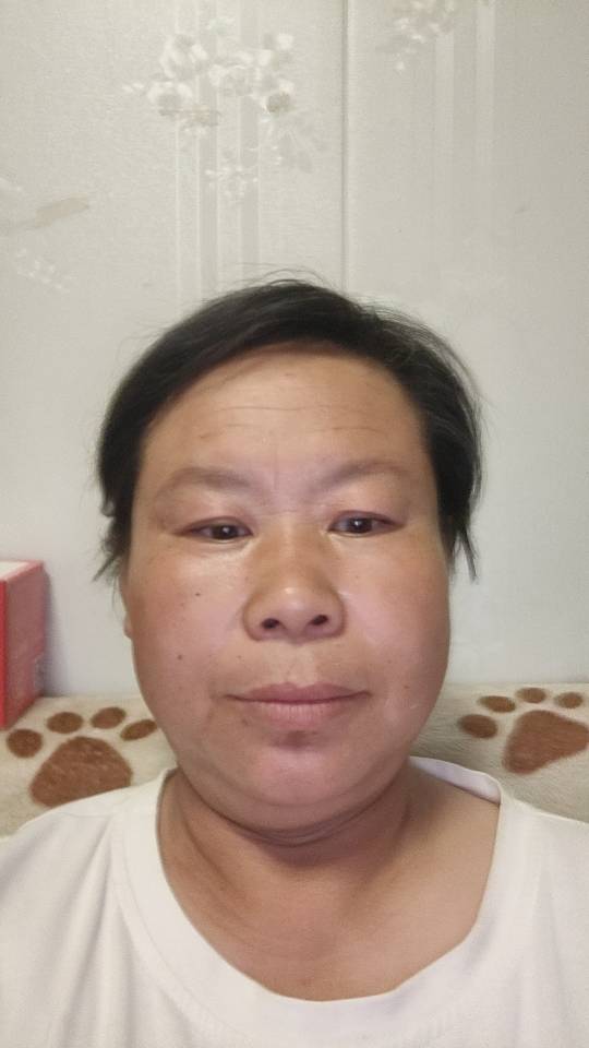 秦护工照片