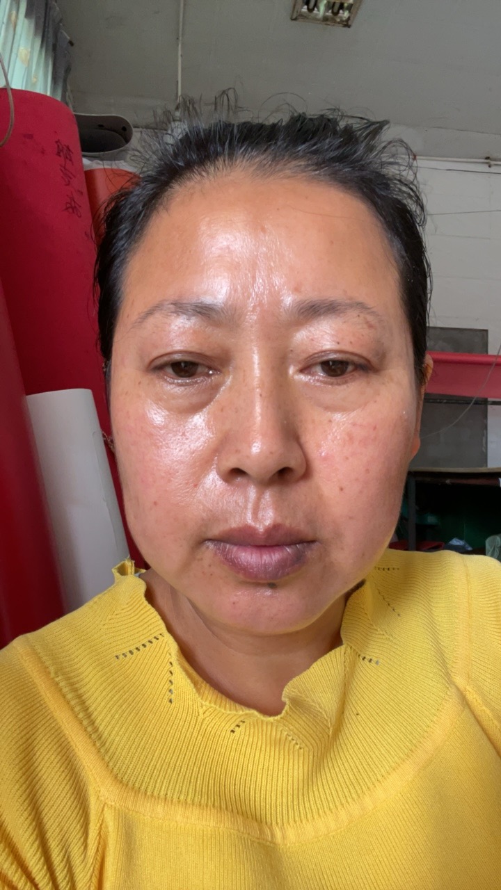 周护工照片