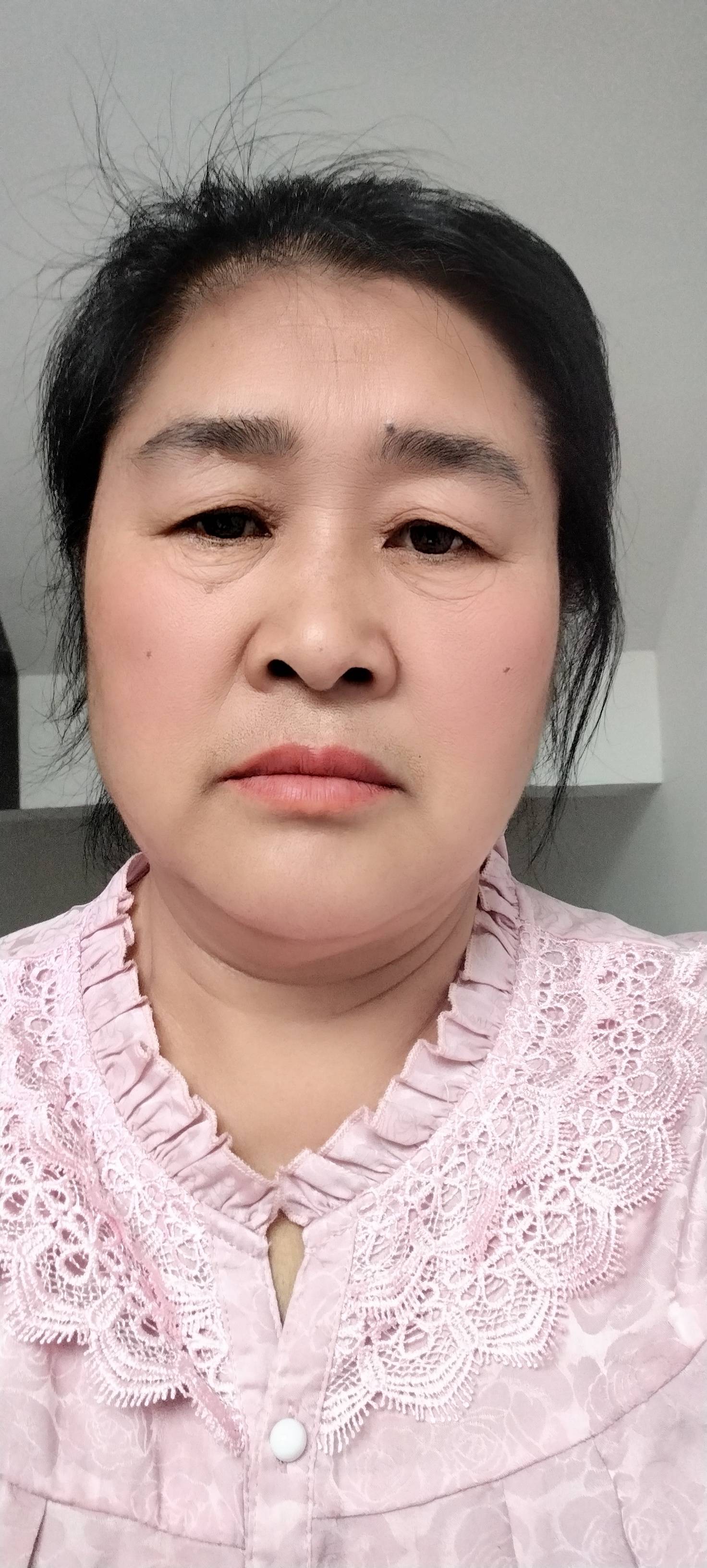 祁阿姨照片