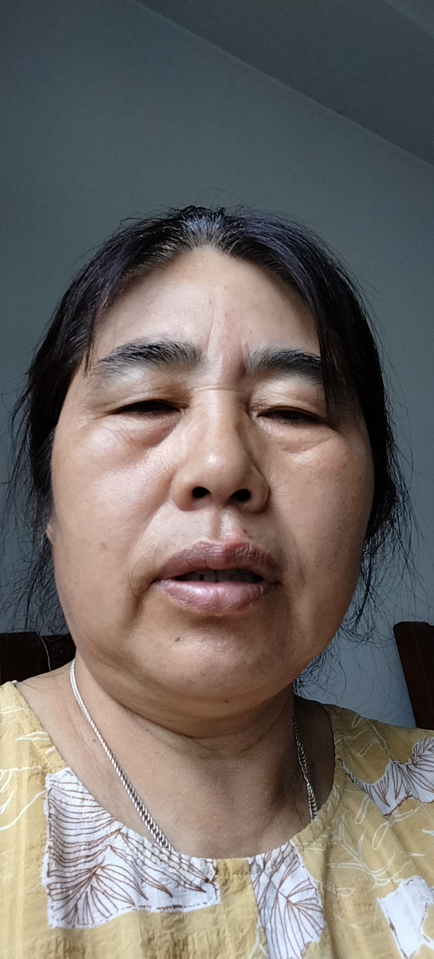 周护工照片