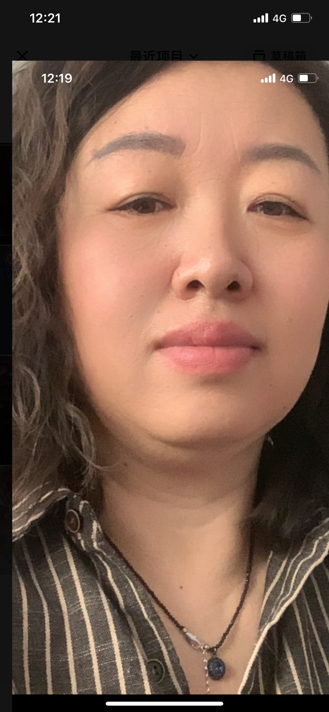 张阿姨照片