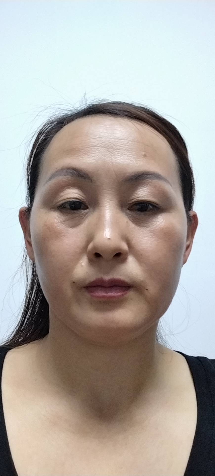 程护工照片