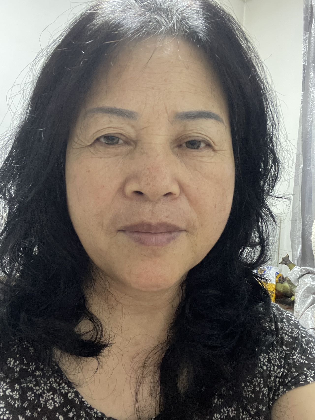 张护工照片