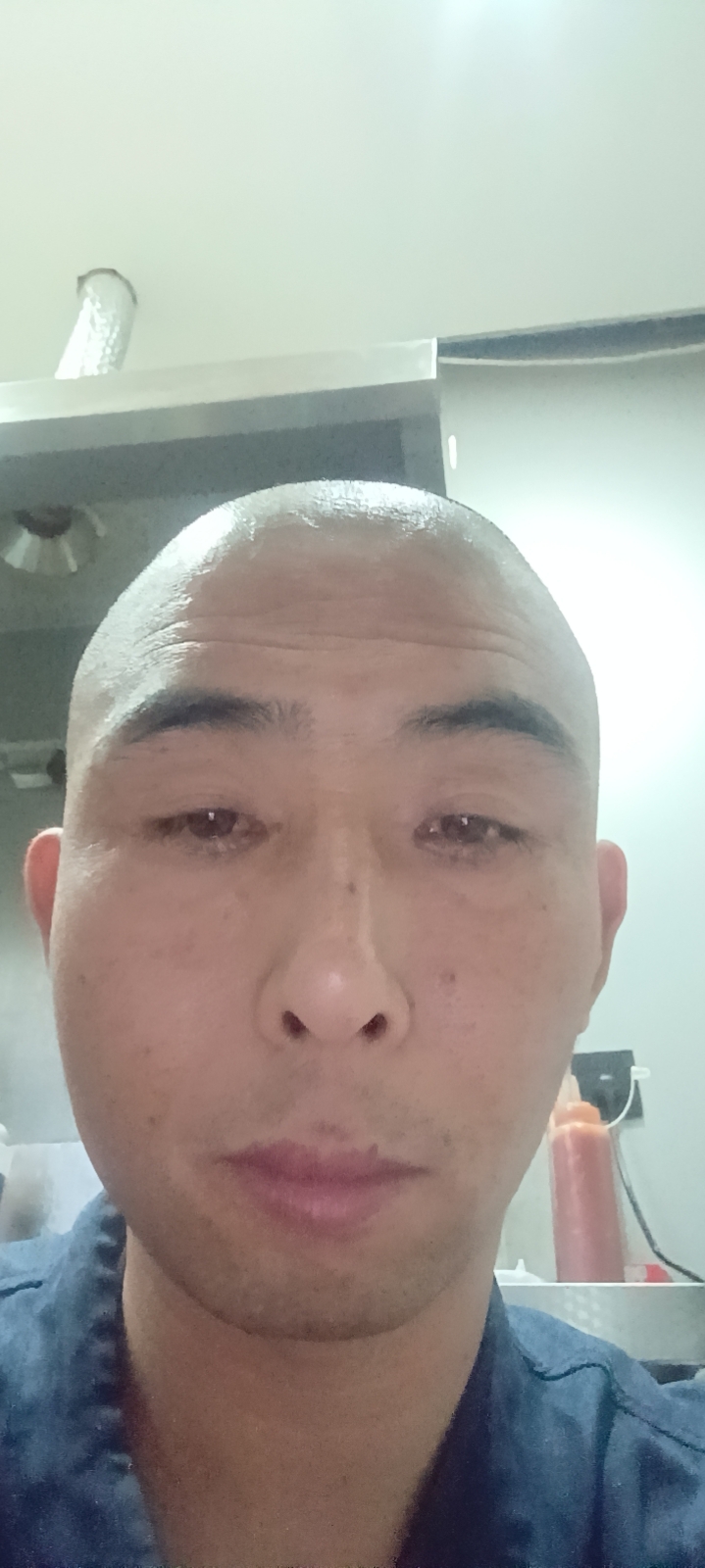 王护工照片