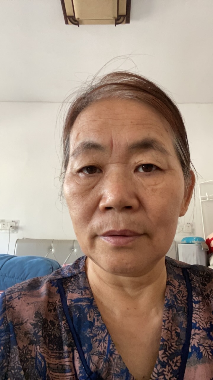 李护工照片