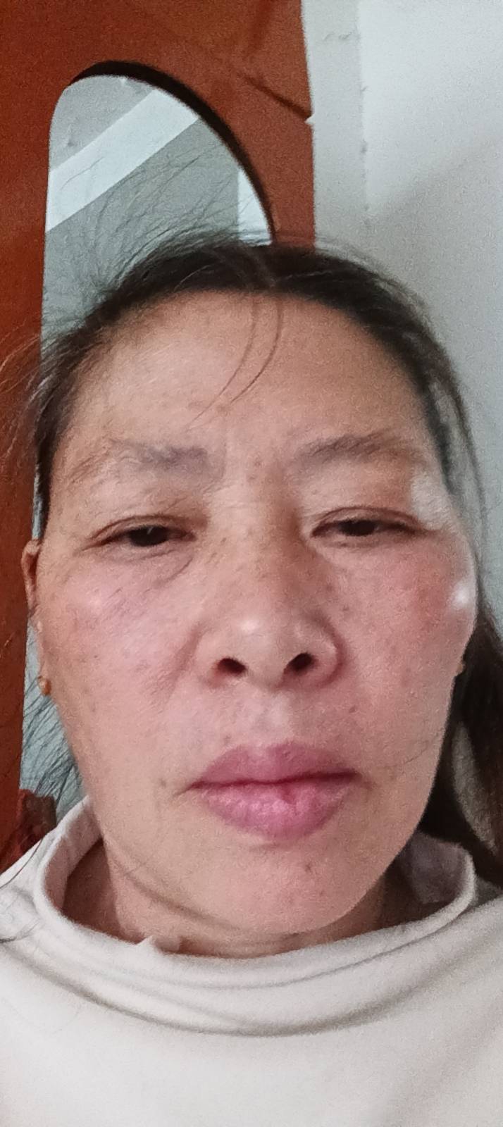 琪护工照片