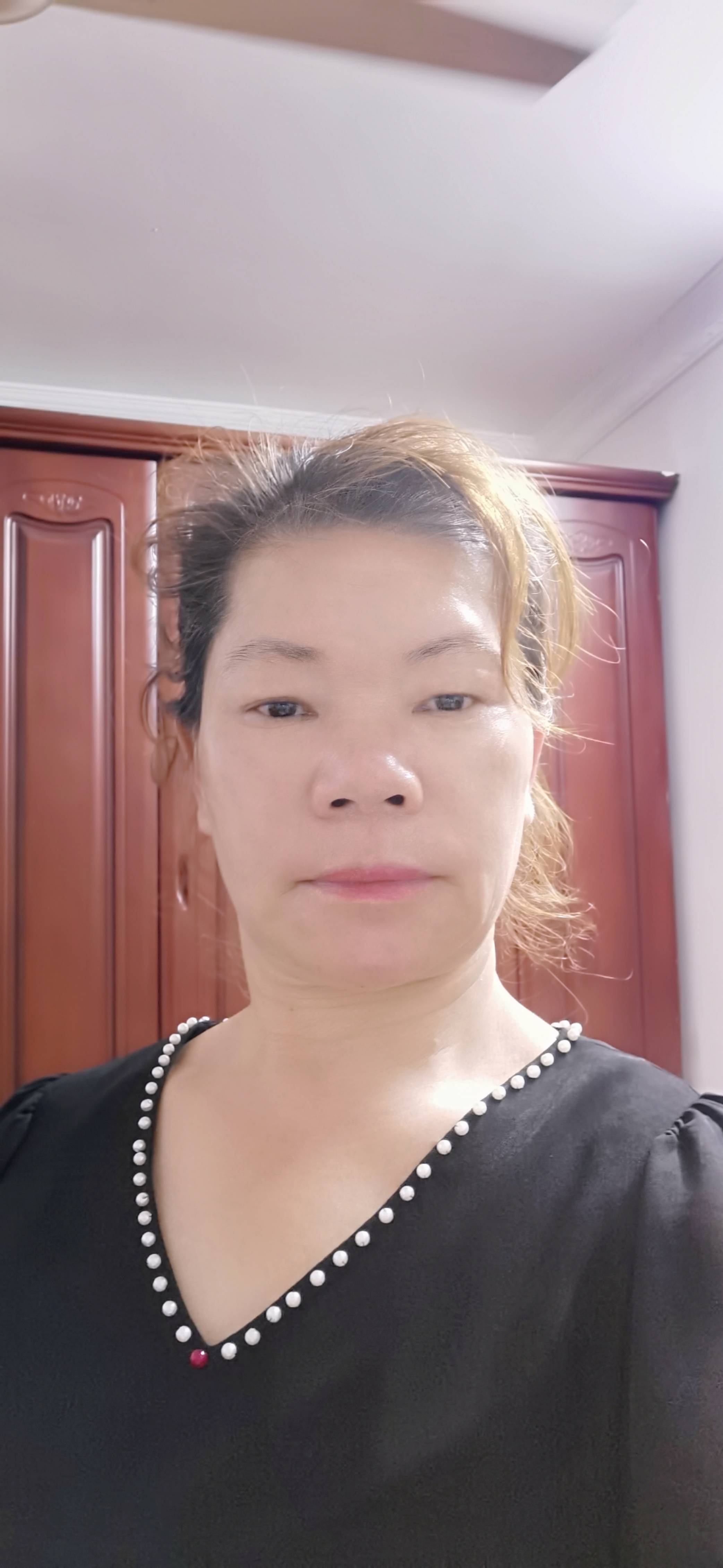 张护工照片