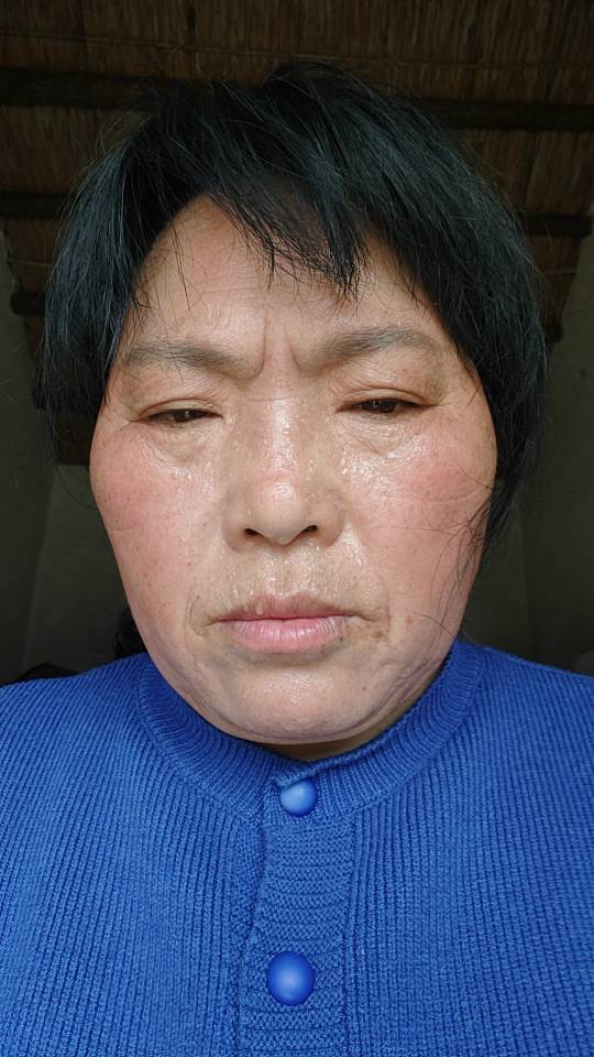 王护工照片