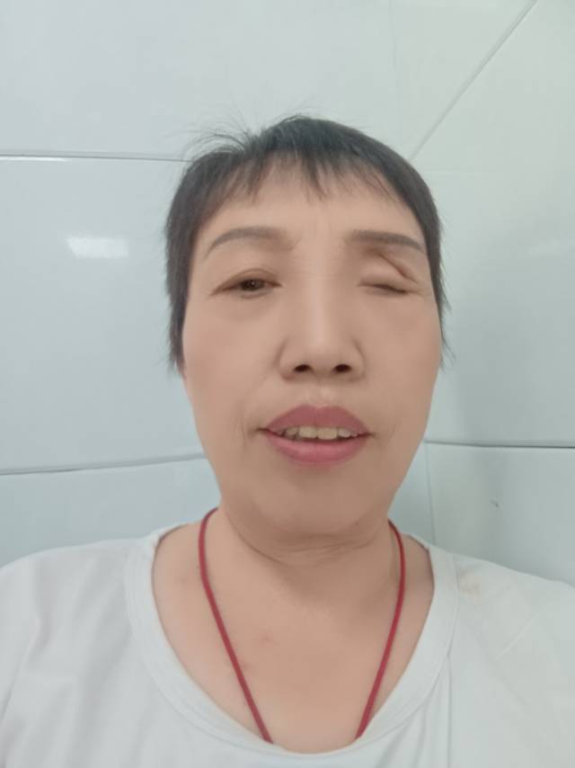 周护工照片